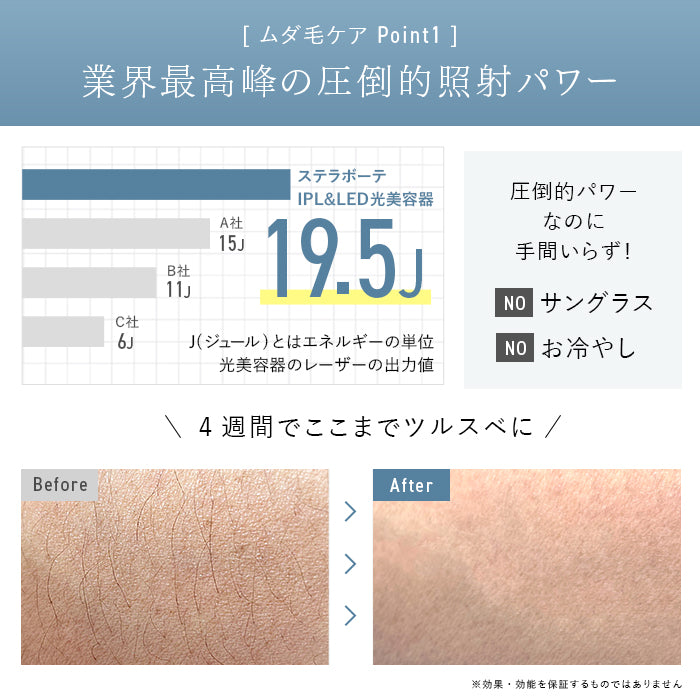 STELLA BEAUTE / ステラボーテ IPL&LED光美容器(脱毛&美顔器)【カラー:2色あり】