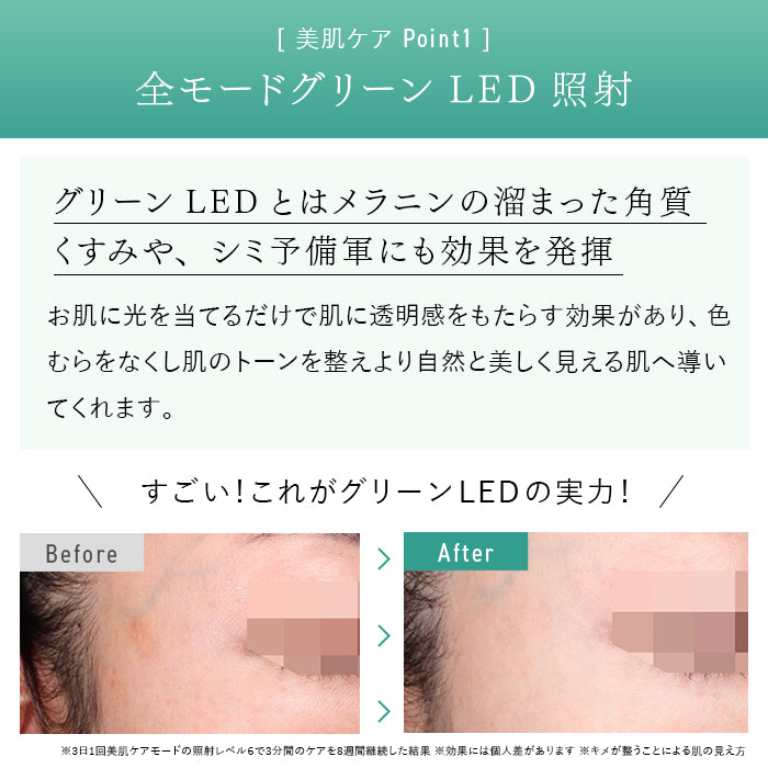 STELLA BEAUTE / ステラボーテ IPL&LED光美容器(脱毛&美顔器)【カラー:2色あり】