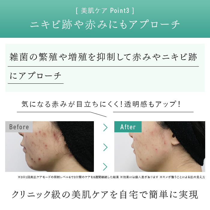 STELLA BEAUTE / ステラボーテ IPL&LED光美容器(脱毛&美顔器)【カラー:2色あり】